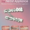 The Herbst Appliance: Research Based Clinical Management