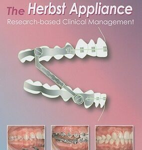 The Herbst Appliance: Research Based Clinical Management