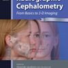 Radiographic Cephalometry, 2Nd Edition