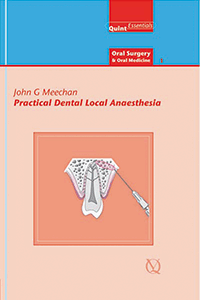 Practical Dental Local Anaesthesia Second Edition