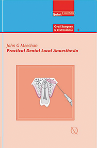Practical Dental Local Anaesthesia Second Edition