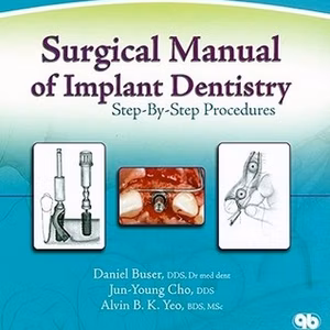 Surgical Manual Of Implant Dentistry