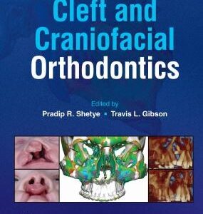 Rehab Complex Cleft Palate & Craniomax