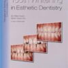 Tooth Whitening In Esthetic Dentistry