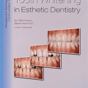 Tooth Whitening In Esthetic Dentistry