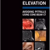 Sinus Floor Elevation: Avoiding Pitfalls Using Cone-Beam Ct