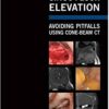 Sinus Floor Elevation: Avoiding Pitfalls Using Cone-Beam Ct