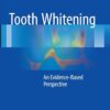 Tooth Whitening