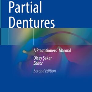 Removable Partial Dentures