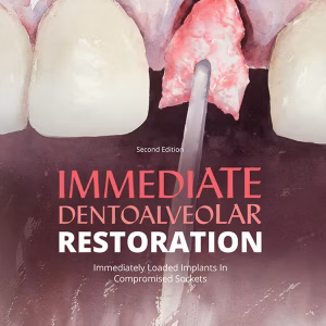 Immediate Dentoaveolar Restoration: Immediate-Loaded Implants In Compromised Alveolar Sockets