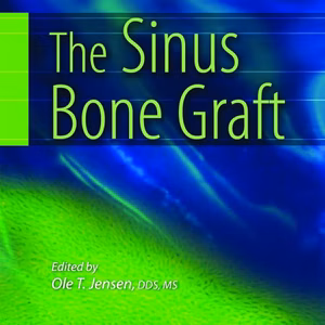 Sinus Bone Graft, 2Nd Edition