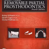 Stewart'S Clinical Removable Partial Prosthodontics, Fourth Edition