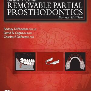 Stewart'S Clinical Removable Partial Prosthodontics, Fourth Edition