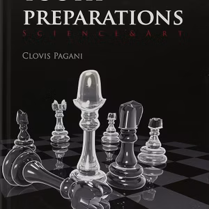 Tooth Preperation Science & Art