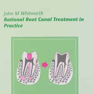 Rational Root Canal Treatment In Practice 2nd Edition