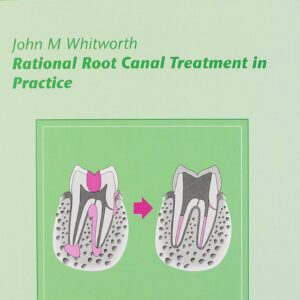 Rational Root Canal Treatment In Practice 2nd Edition
