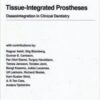 Tissue-Integrated Prostheses Osseo