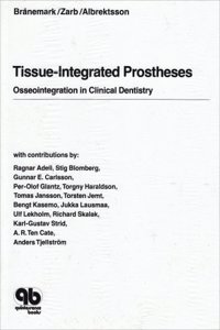 Tissue-Integrated Prostheses Osseo