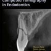 Cone Beam Computed Tomography In Endodontics