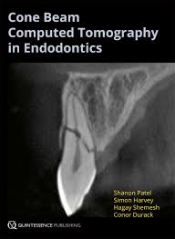 Cone Beam Computed Tomography In Endodontics