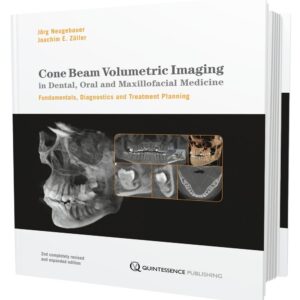 Cone Beam Volumetric Imaging In Dental, Oral And Maxillofacial Medicine