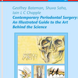 Contemporary Periodontal Surgery: An Illustrated Guide to the Art behind the Science