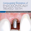 Contemporary Restoration Of Endodontically Treated Teeth