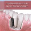 Controversial Issues In Implant Dentistry