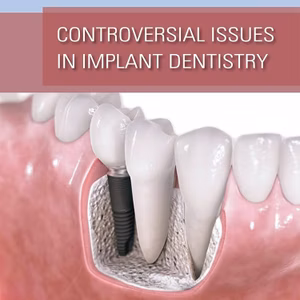 Controversial Issues In Implant Dentistry