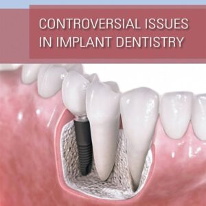 Controversial Issues In Implant Dentistry