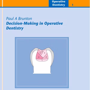 Decision-Making In Operative Dentistry
