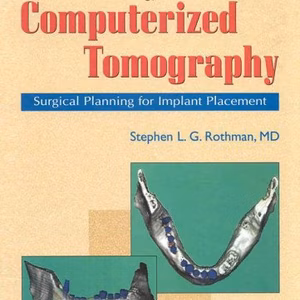 Dental Applications Computer Tomography