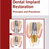 Dental Implant Restoration