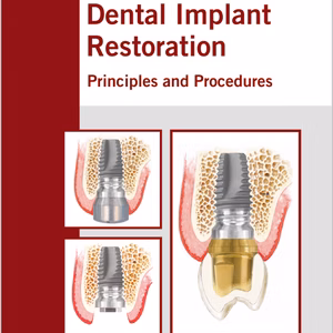 Dental Implant Restoration