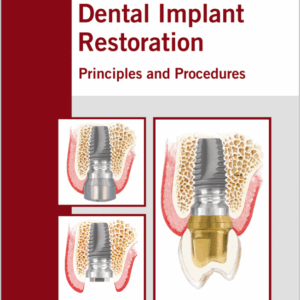 Dental Implant Restoration