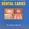 Diagnosis & Risk Predict Dental Car Volii