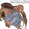 Digital Implantology