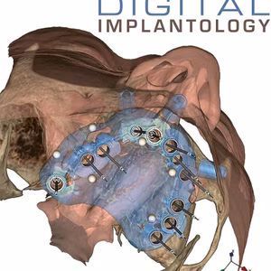 Digital Implantology