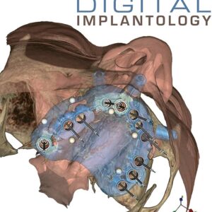 Digital Implantology