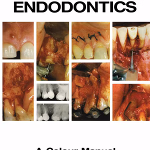 Endodontic Surgery