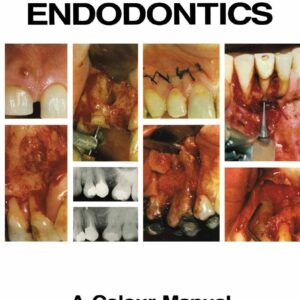 Endodontic Surgery