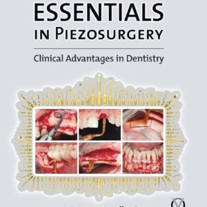 Essentials In Piezosurgery:Clinical Advantages In Dentistry