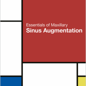 Essentials Of Maxillary Sinus Augmentation