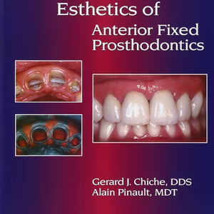 Esthetics Anterior Fixed Prosth