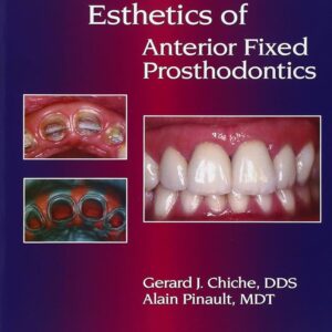 Esthetics Anterior Fixed Prosth