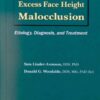 Excess Face Height Malocclusion: Etiology, Diagnosis, and Treatment