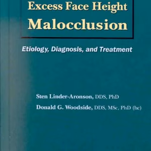 Excess Face Height Malocclusion: Etiology, Diagnosis, and Treatment