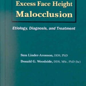 Excess Face Height Malocclusion: Etiology, Diagnosis, and Treatment