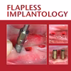 Flapless Implantology