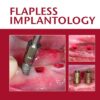 Flapless Implantology